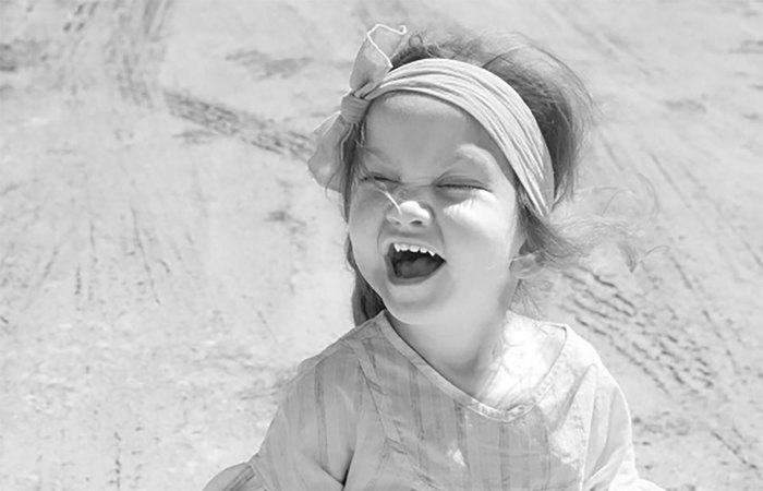 Child with Kabuki syndrome.