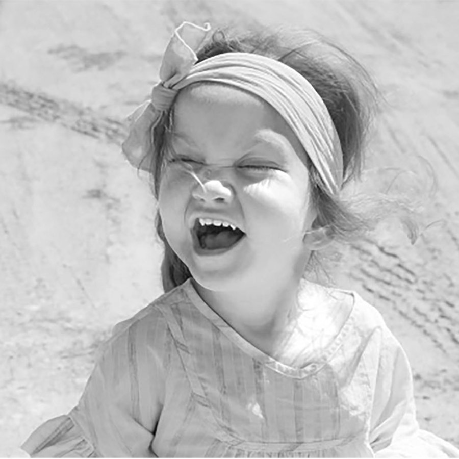 Child with Kabuki syndrome.
