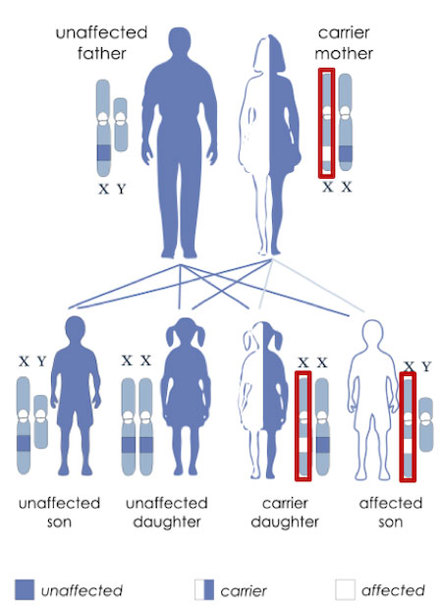 Inheritance pattern for Duchenne muscular dystrophy.