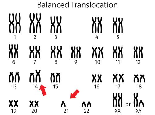 Chromosomes of person with a balanced translocation