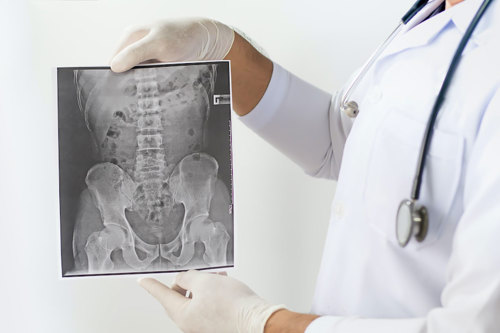 Spine X-ray.