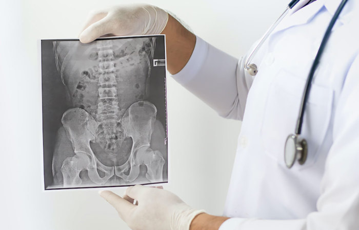 Spine X-ray.