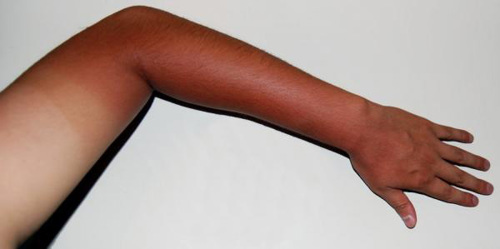 Tanned arm.