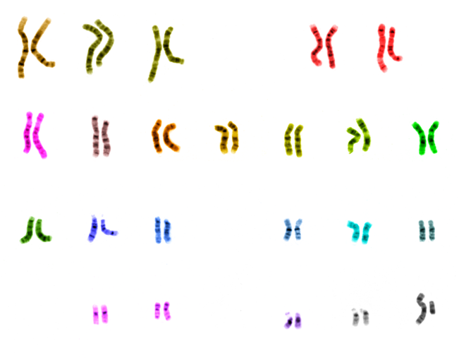 Colored karyotype.
