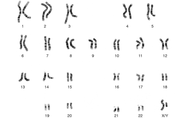 Human chromosomes.