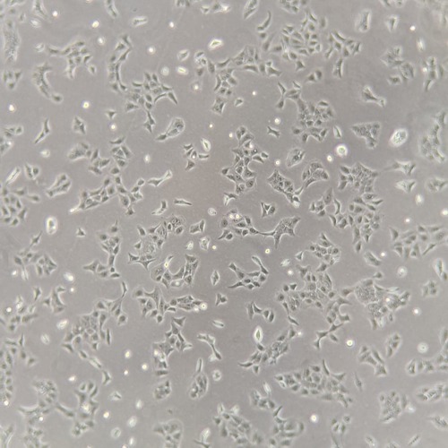 Black and white microscopy image of human skin cells growing in a petri dish at 100x magnification.
