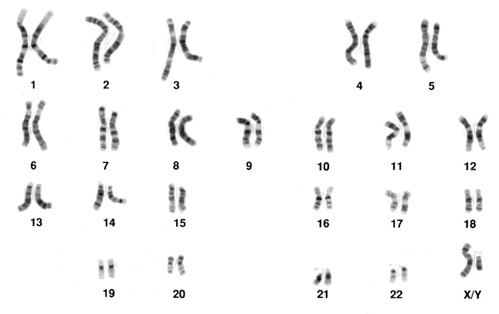 23 pairs of chromosomes.