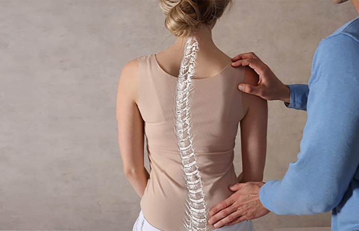 Scoliosis spine posture correction.