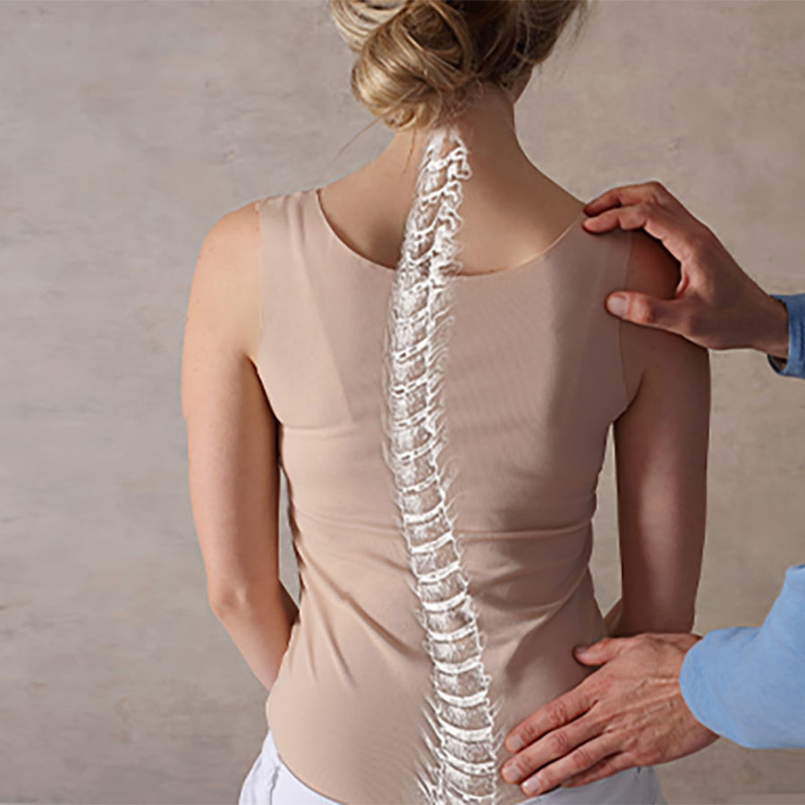 Scoliosis spine posture correction.