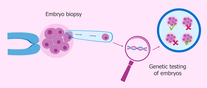 A cell being taken from an embryo to look at the DNA.