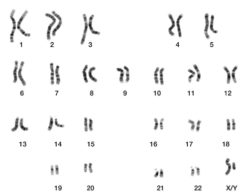Karyotype of human chromosomes.