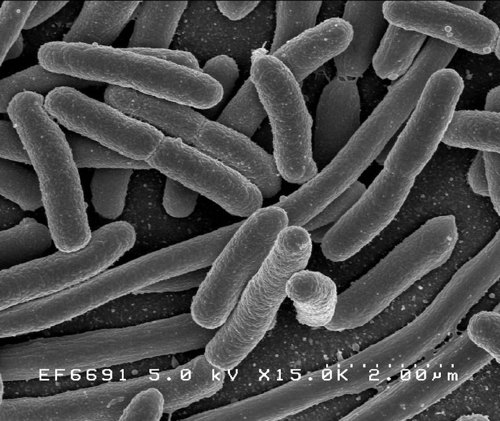 E coli bacteria.