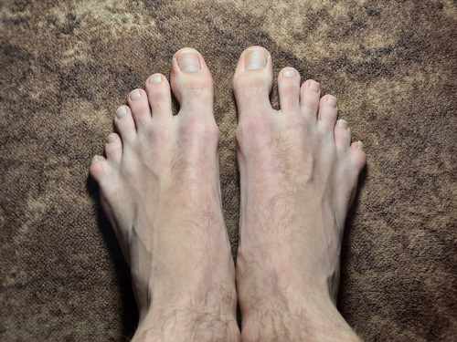 Feet with six toes each.