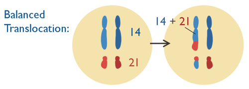 Balanced translocation