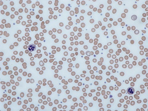 Image of blood smear stain, showing hundreds of red blood cells.