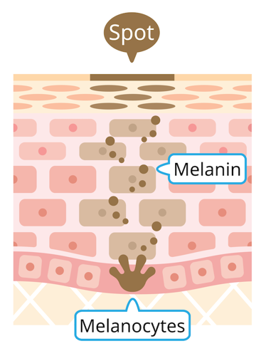 Illustration of a melanocyte cell near the bottom of a layer of skin cells, producing a cluster of melanin pigment.