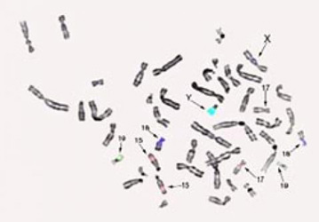 Chromosomes.