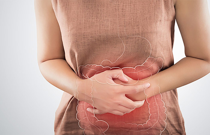 Woman with a large intestine.