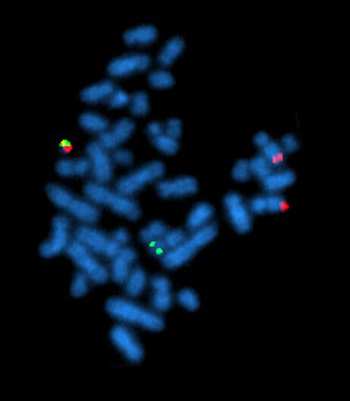 Chromosome staining.