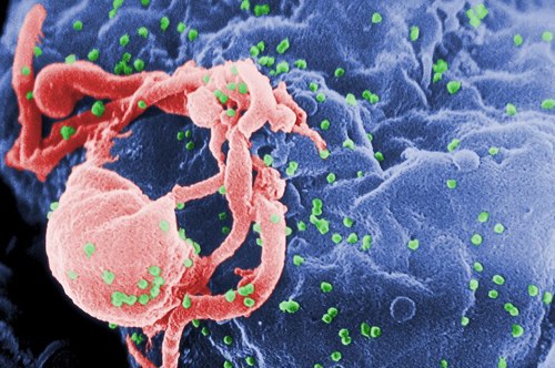Scanning electron micrograph of HIV-1 budding (in green) from cultured lymphocyte.