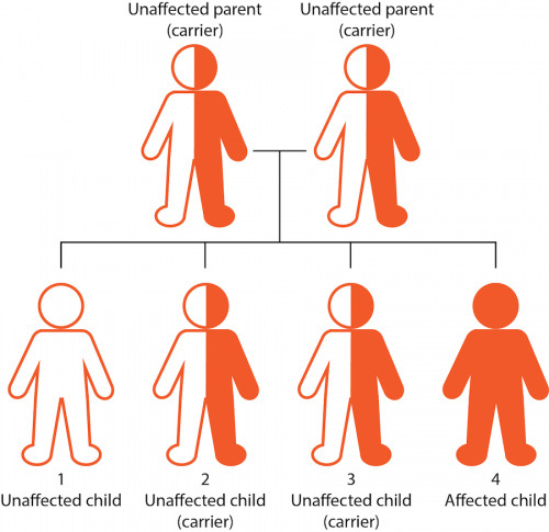 Recessive inheritance for two parents who are carriers.