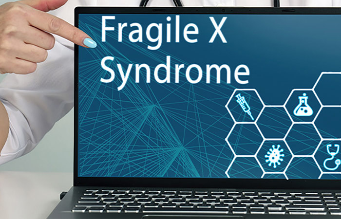 Fragile X medical computer.