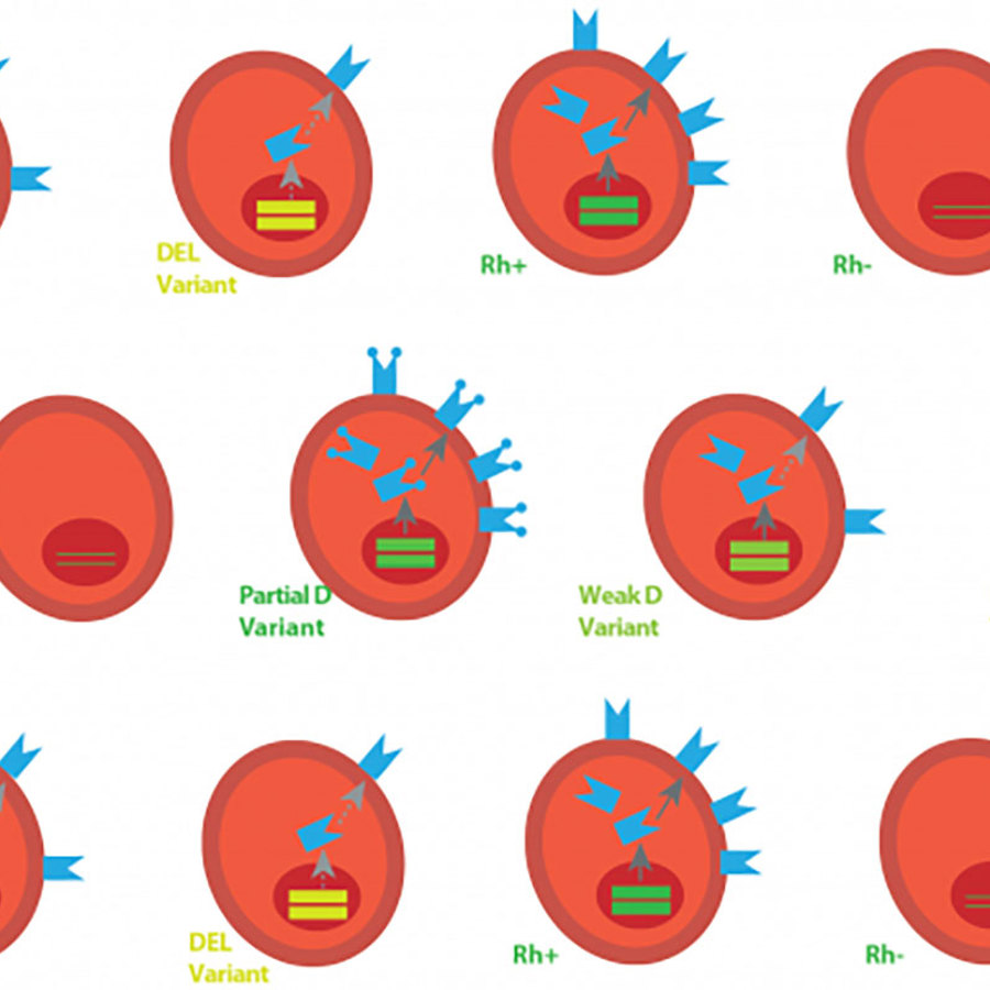 Rhd gene variants.