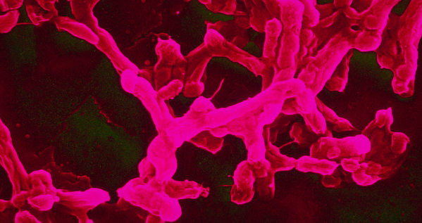 Salmonella typhi bacteria