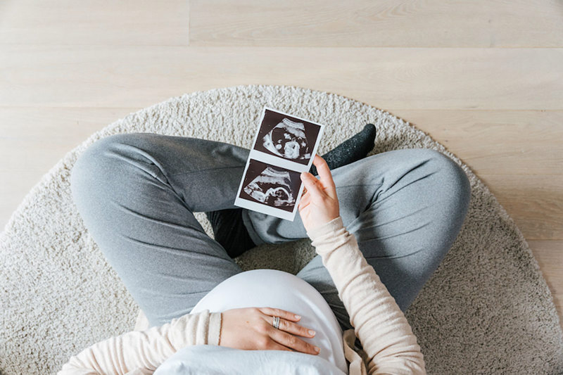 Pregnant woman holding a sonogram.