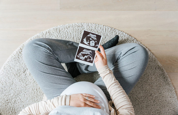 Pregnant woman holding a sonogram.