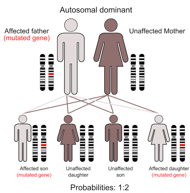 Autosomal dominant inheritance.