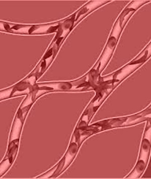 Sickle shaped blood cells.