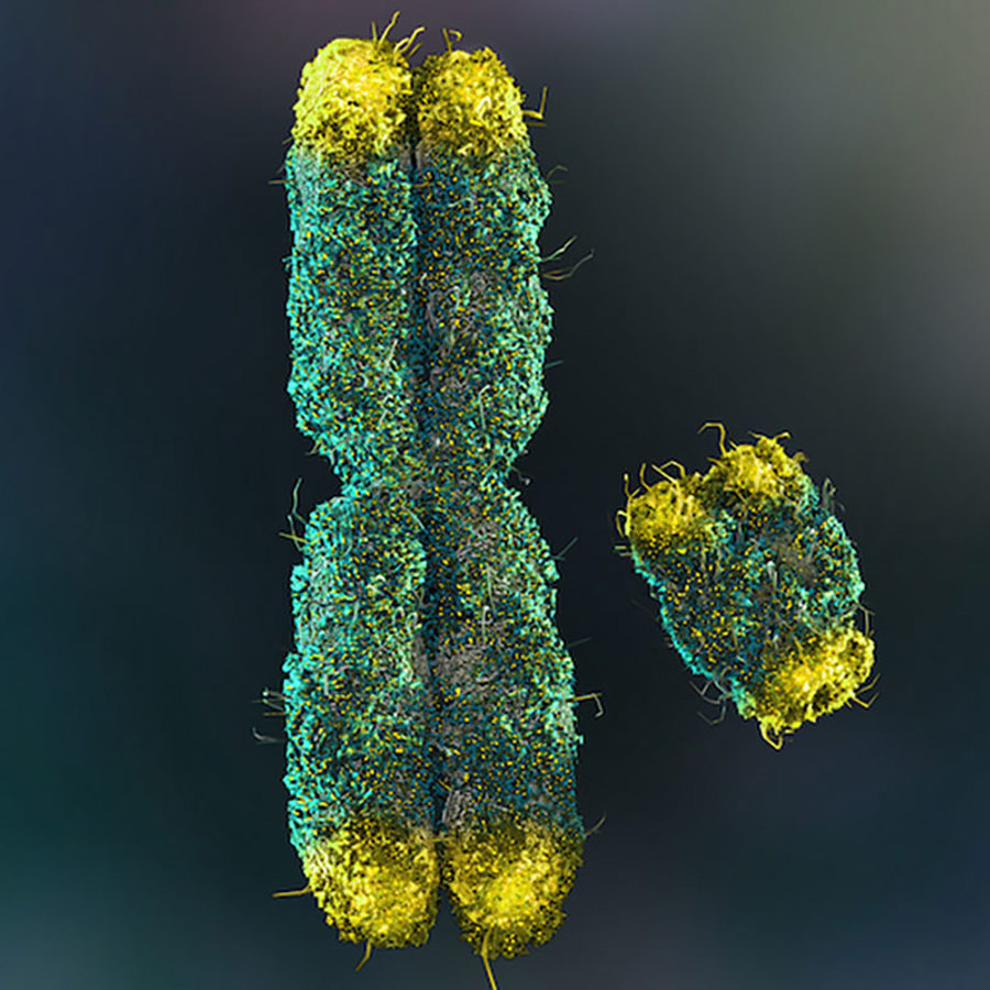 X and Y chromosomes.