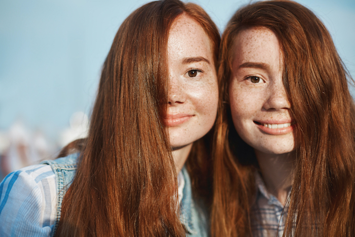 Twins with freckles.