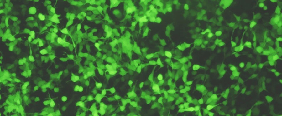 Green fluorescent protein (GFP) cancer cells.