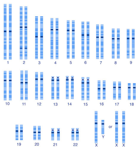 A karyotype with XX and XY sex chromosomes.