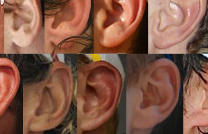 A range of both attached and unattached earlobes.
