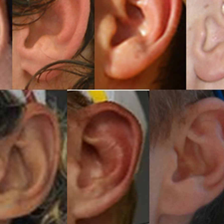 A range of both attached and unattached earlobes.
