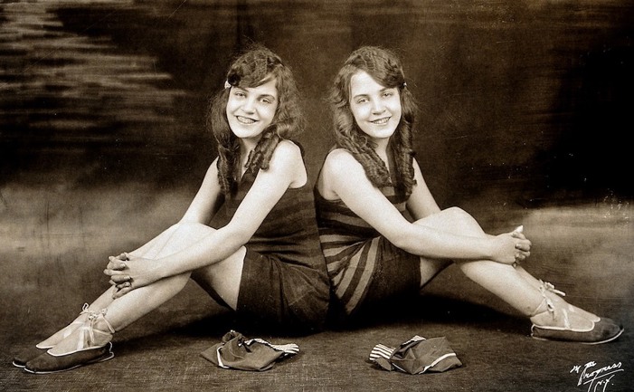 Daisy and Violet Hilton, conjoined twins.