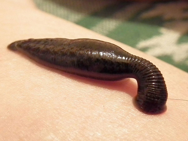 Leech sucking blood.