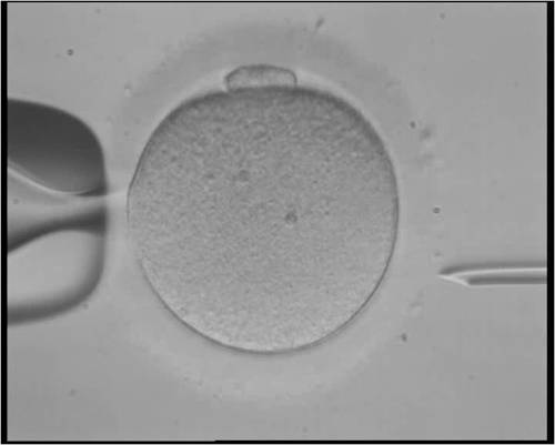 In vitro fertilization of an embryo