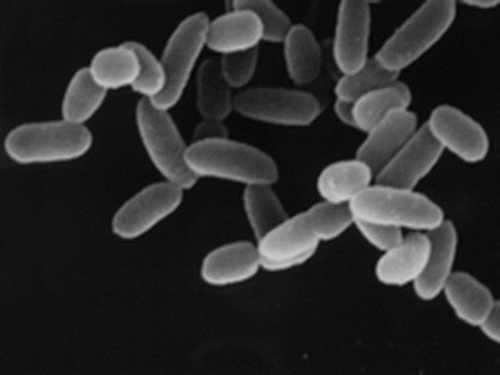 Microscopy of archaea.
