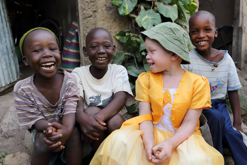 Four Black children from Tanzania, one of whom has albinism.