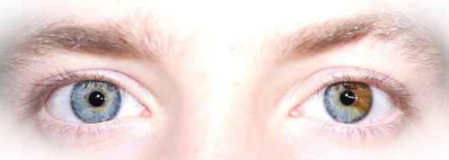 Eyes with heterochromia.