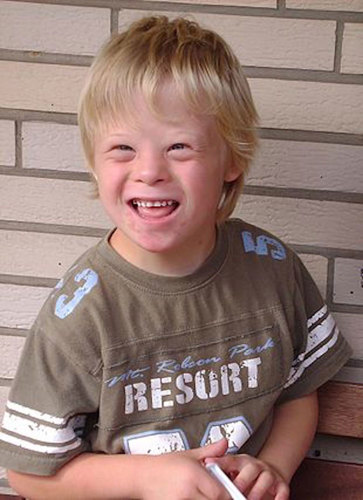Boy with Down Syndrome.
